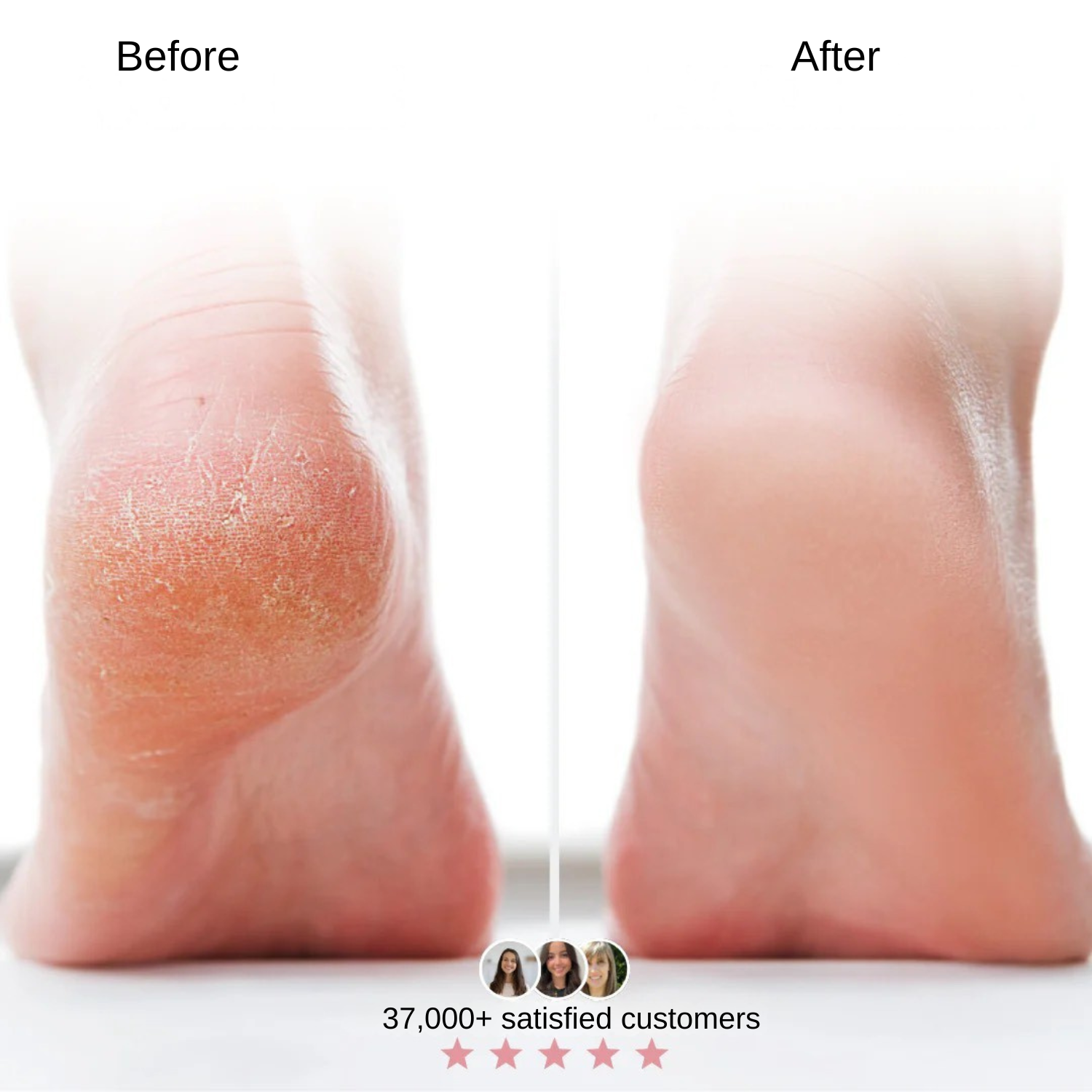 GlowStep-Pro™ incl. 40 free pads